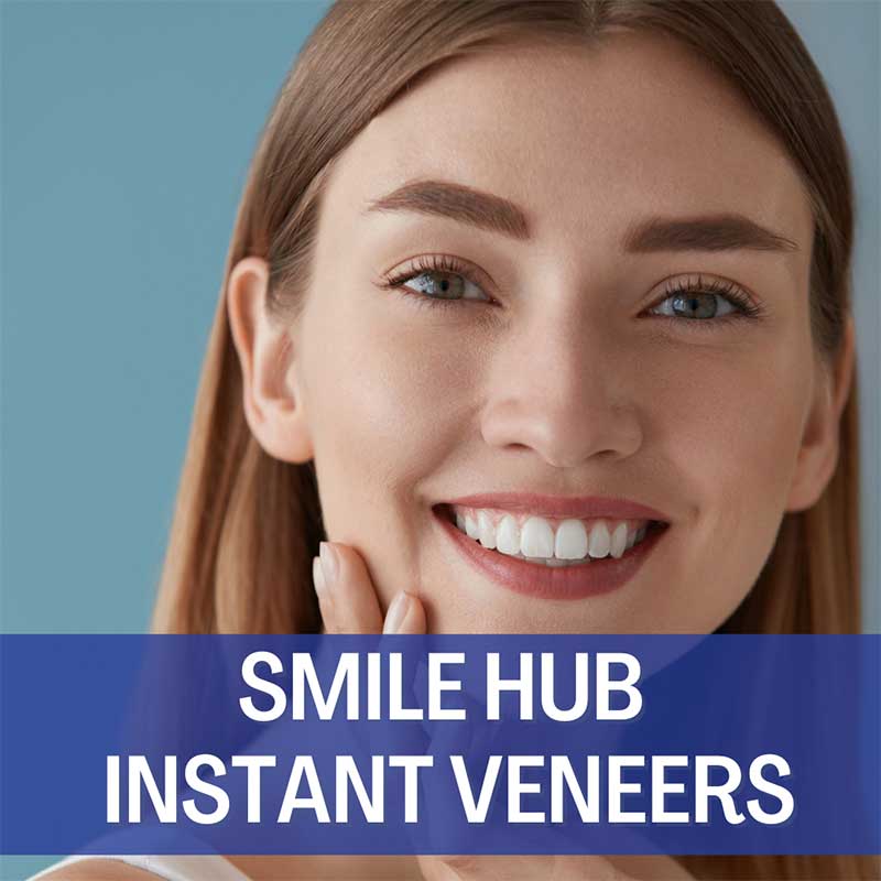 SH-12740-InstantVeneers-FB-#4